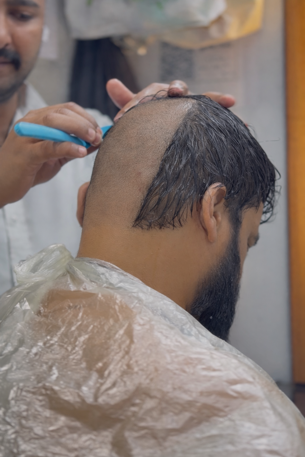 Hair Removal